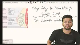 History taking of Breast Lump | Cancer for UG & PG | Case Presentation | Surgery Clinical