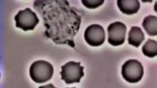 Neutrophil Phagocytosis