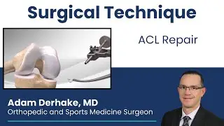 ACL: Surgical Technique