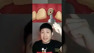 GIGI COWOK INI HANCUR DIMAKAN ULAT | Yosua Andre 