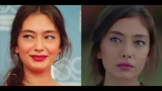 Neslihan Atagul - Kara Sevda Nihan - Burun Estetigi