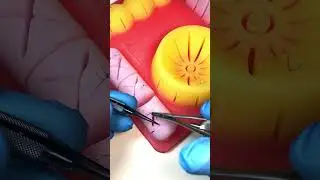 Грозное осложнение - сепсис | Тренажер Scalpel med