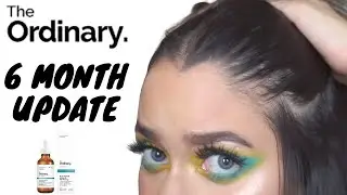 The Ordinary Multi-Peptide Serum for Hair Density: 6 Month Update!