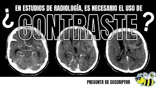 Es necesario el contraste en un estudio de radiologia?
