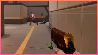 Patient Dont Do Anything Stupid | Valorant Funny Clip