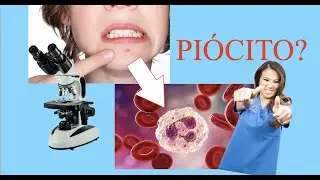 O que tem DENTRO da SUA ESPINHA?? - Vimos no MICROSCÓPIO!!