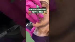 Fine Lines Have No Place Here