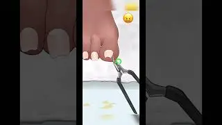 Asmr nail cut 