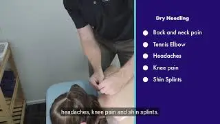 What is Dry Needling? - Health First Group
