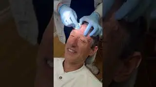Botox technique to make Dr. Antolak look younger