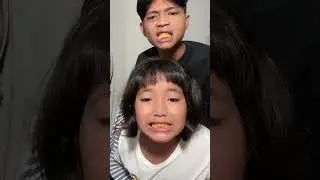 PRANK SISTER-IN-LAW WITH YELLOW TEETH 😂 AUTO EMBARRASSED
