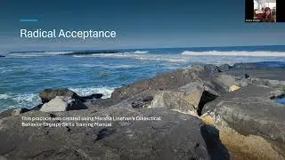 Radical Acceptance revised