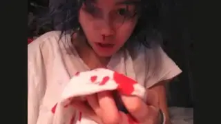 I FILMED ONE OF MY DAILY NOSE BLEEDS | Kylie The Jellyfish