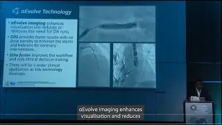 Dr. Pasupati video: AI and advances in Cardiac Intervention