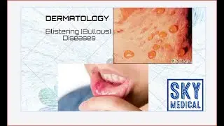 Blistering (Bullous) Diseases