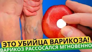 CHINESE KILLER OF VARICOSE AND VASCULAR STARS! For 15 minutes a day...Legs BECAME LIGHT AND CLEAN!