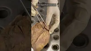 Heart superficial structures #7 | Anatomy Thorax | #mbbs #neet #viral #shorts #shortfeed