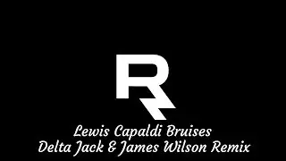 Lewis Capaldi - Bruises (Delta Jack Remix) ϟSped up and Boosted By James Wilsonϟ