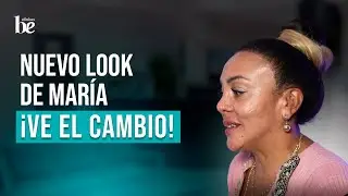 Injerto Capilar de María Cedelonia, Reducción de Frente en Raza Afroamericana en Clínicas Be 🌍