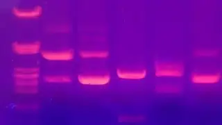 Agarose Gel Electrophoresis - Amrita University