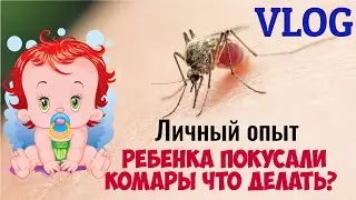 ВЛОГ. РЕБЕНКА ПОКУСАЛИ КОМАРЫ. ЧТО ДЕЛАТЬ? ЛИЧНЫЙ ОПЫТ.