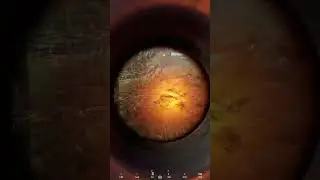 Watch Out For The Trees In SQUAD