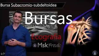 ECOGRAFÍA DE LAS BURSAS DEL HOMBRO (PARTE II)