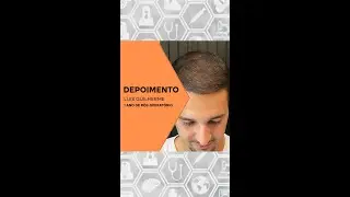 1 ANO DE PÓS-OPERATÓRIO DE TRANSPLANTE — DEPOIMENTO PCT LUIS