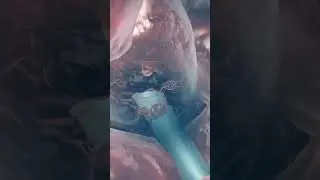 How Liver Biopsy Is Performed? | Complete Guide To Liver Biopsy