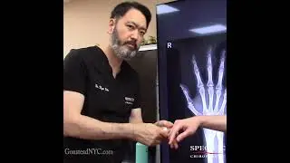 Knuckle Pain | Finger Pain RELIEF 