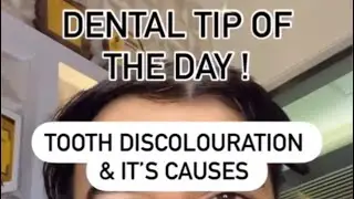 Understanding Tooth Discoloration: Key Factors for Dentists, Students, and Patients