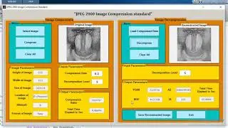 JPEG2000 Image compression MATLAB project source code