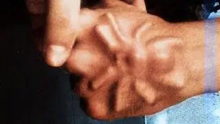 10 Things Found Living Inside Humans