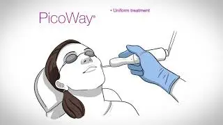 PicoWay - Gerçek Pikosaniye Lazer Teknolojisi nedir?