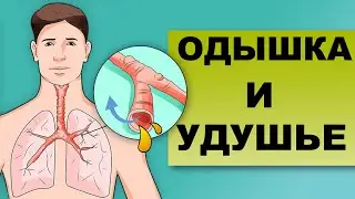 Shortness of breath and suffocation