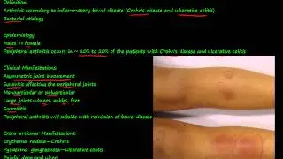 100P - Enteropathic Arthropathy