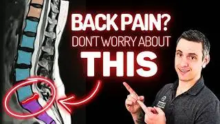 Back Pain? Don't Worry About The Disc Herniation