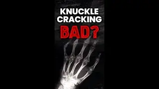 Is cracking your knuckles bad? 