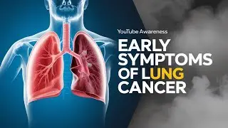 Don’t Ignore These Early Signs of Lung Cancer! #health #healthnews