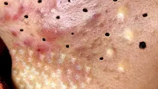 تلميع وتنظيف الجلد الطبيعي المدور 1413591