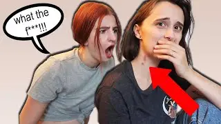 WIFE DOES HICKEY PRANK (BAD IDEA)