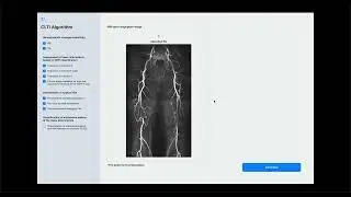 CLTI diagnosis - Demo