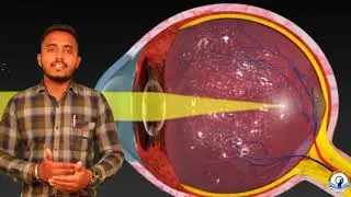 Defects of vision by Roheet Jaisheel CLASS  X & XII (PHYSICS) CBSE / ICSE 3D | Bright Light Classes