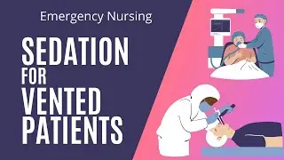 Sedation for Intubated patients - Propofol, Versed, Precedex and Fentanyl