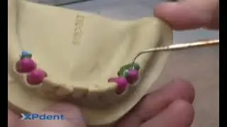 VKS-SG Attachment System