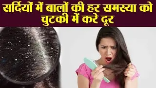 डैंड्रफ हो या खुजली,सर्दियों में बालों की समस्या करे मिनटों में दूर। Winter Hair Care Tips । Boldsky