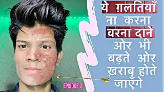 6 MISTAKES THAT MAKES YOUR PIMPLE MORE GROW AND MAKE YOUR SKIN WIRED|2nd episode|AHMAD STYLING