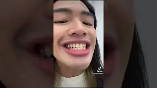 The Pambansan Bortang Barbie gets his teeth whitened!
