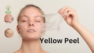 Unlock the secrets of the Yellow Peel with our comprehensive online course