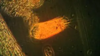 Stylonychia (video 1)